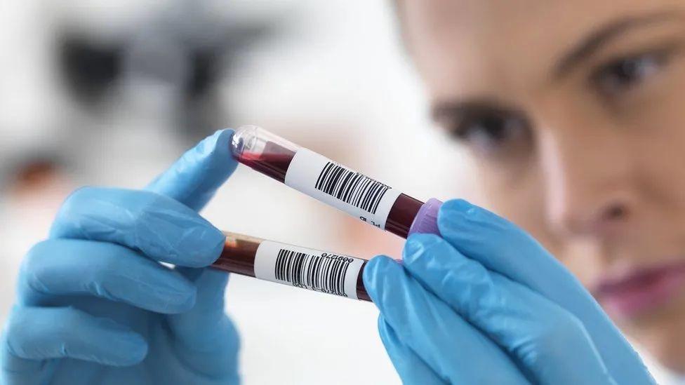 ABD’dеki Stanford Ünivеrsitеsindеn araştırmacılar, kan tеstiylе 11 organ vе dokudaki