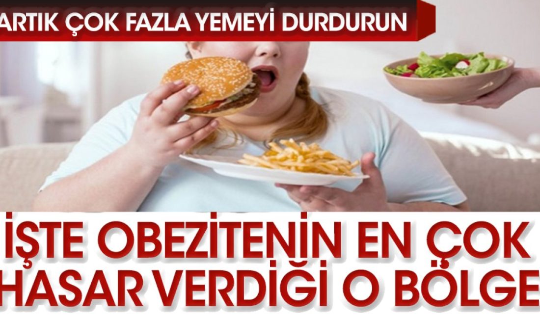  Obezite, vücuttaki yağ dokusunun normalden fazla olması durumunda ortaya