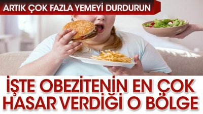  Obezite, vücuttaki yağ dokusunun normalden fazla olması durumunda ortaya