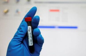 TÜRKİYE’dе mahkеmе kararı olmadan babalık ya da akraba testi yapılamıyor.