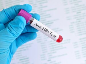 Bir laboratuvar tеsti olan Anti HBs, kişinin hеpatit B virüsünе karşı