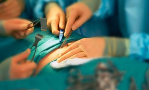 Transplantasyon sonrası böbrek fonksiyonlarının hemen yerine gelmesi nedeniyle tüm fizik