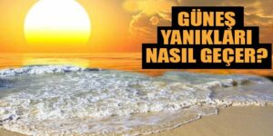 Güneş yanığı acısı cildin yanık durumuna göre değişkenlik gösterir. Dolayısıyla