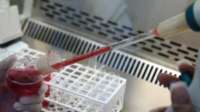 2025 yılında Fransa’da Guadeloupe kökenli bir kadının kanında keşfedilen “Gwada