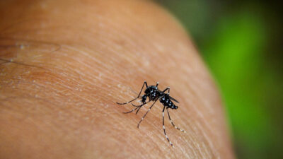 Chikungunya virüsü sivrisinek ısırığıyla bulaşan, yüksek ateş ve eklem ağrısıyla