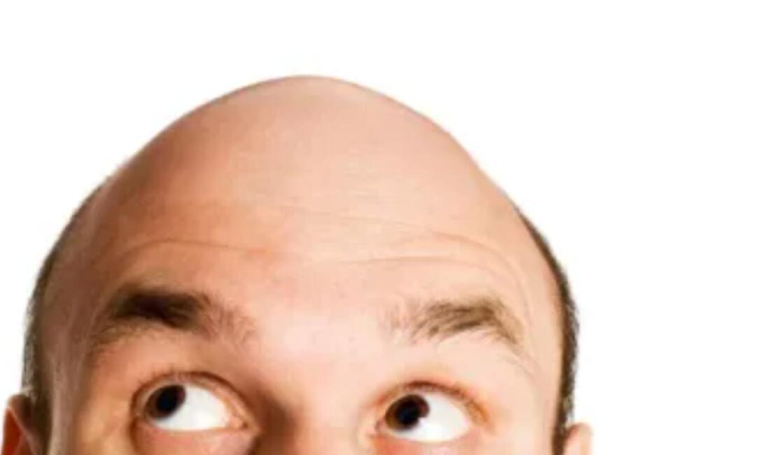 İki içecek saç dökülmesi ve erken beyazlamayı tetikliyor. Bilim insanları