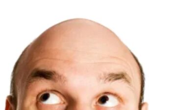 İki içecek saç dökülmesi ve erken beyazlamayı tetikliyor. Bilim insanları